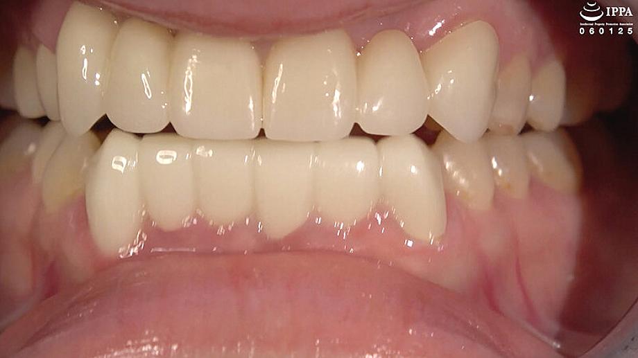 AD-01998 JAV Films 中文 - 00:03:00 - 00:05:00