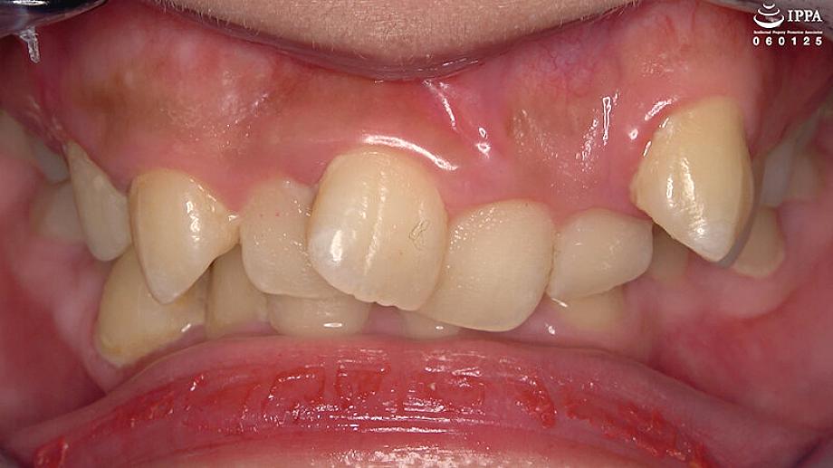 AD-02007 JAV Films 日本語 - 00:02:00 - 00:03:00