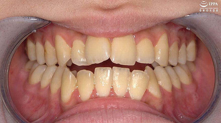 AD-02017 JAV Films 日本語 - 00:01:00 - 00:02:00