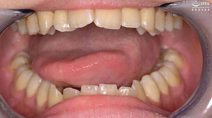 AD-02017 JAV Films 日本語 - 00:02:00 - 00:03:00