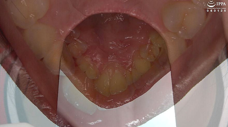 AD-02017 JAV Films 日本語 - 00:05:00 - 00:06:00