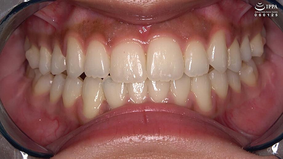 AD-02026 JAV Films English - 00:01:00 - 00:02:00