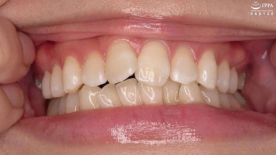 AD-02042 JAV Films English - 00:02:00 - 00:03:00