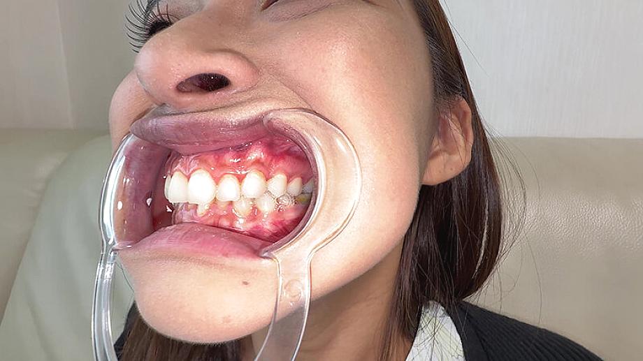 Y-311 JAV Films 日本語 - 00:07:00 - 00:07:00