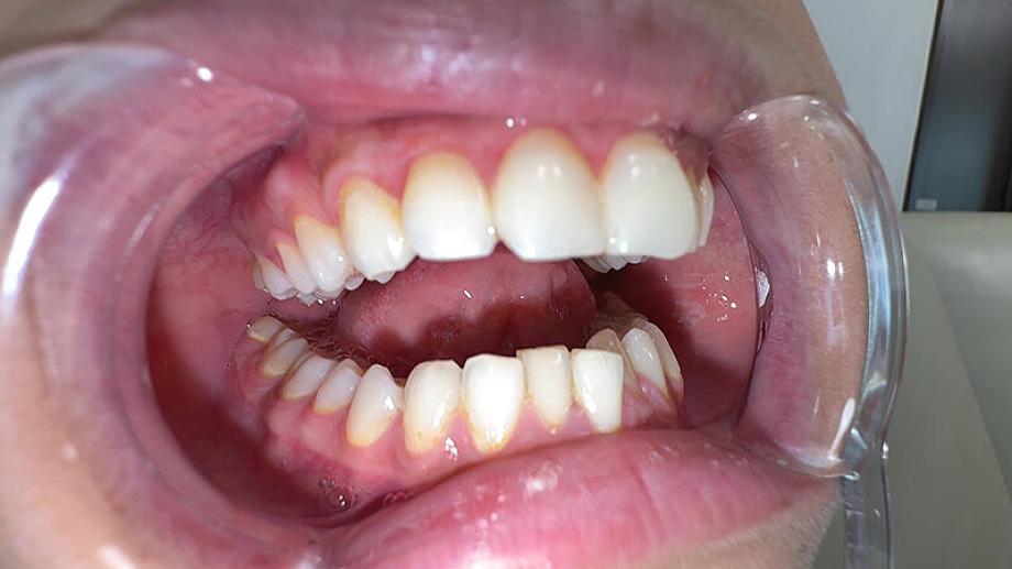 Y-311 JAV Films 日本語 - 00:08:00 - 00:09:00