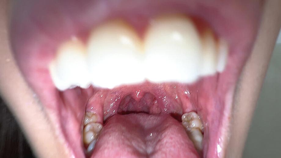 Y-311 JAV Films 日本語 - 00:03:00 - 00:04:00