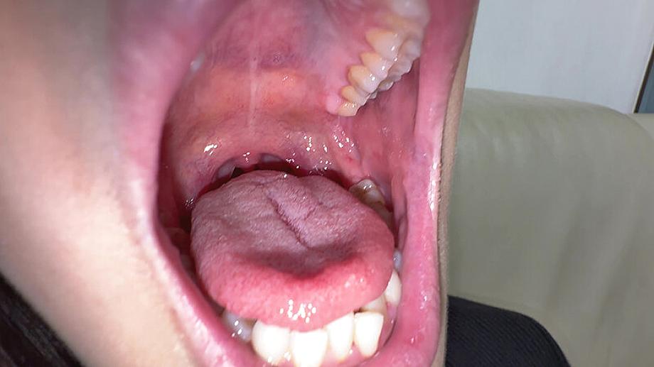 Y-311 JAV Films 日本語 - 00:04:00 - 00:05:00