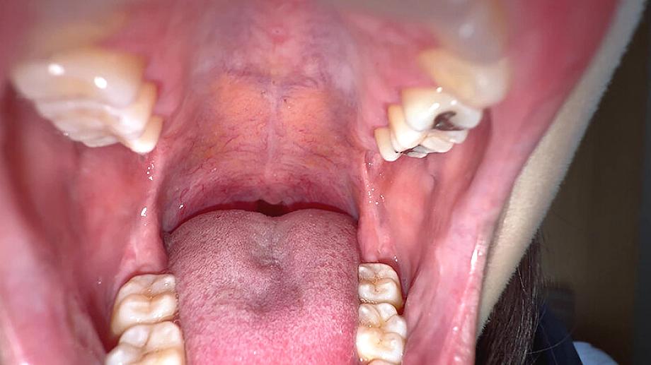 Y-326 JAV Films English - 00:05:00 - 00:05:00