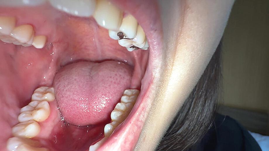 Y-326 JAV Films English - 00:06:00 - 00:07:00